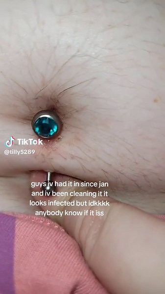 Is My Belly Piercing Infected?