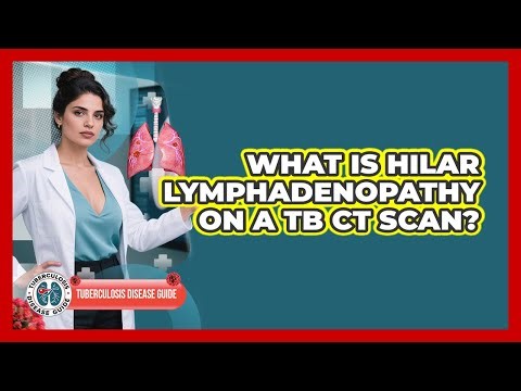 What Is Hilar Lymphadenopathy On A TB CT Scan? - Tuberculosis Disease Guide