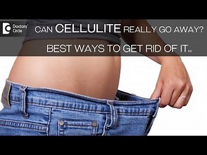 Cellulite: Types, Treatment, Causes - Dr.K.C. Nischal
