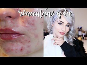 ROACCUTANE Q&A - Mental Health, Side Effects & Products!