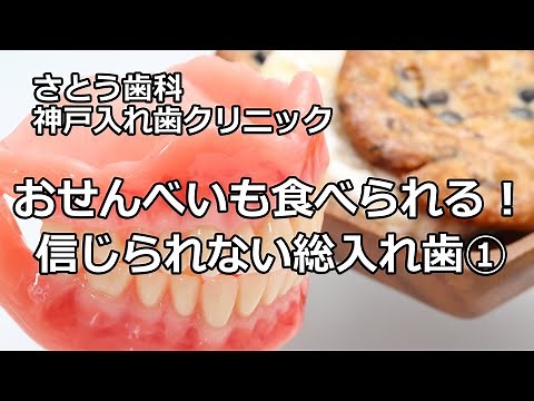 おせんべいも食べられる総入れ歯①【さとう歯科 神戸入れ歯クリニック】