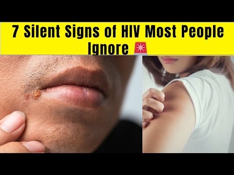 7 Common Symptoms That Could Mean HIV