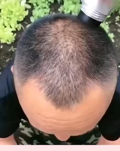 Hair Shadow Powder🥰 Up To 10% Off Free Delivery🔥 See HERE>>goldvendorhub.com/hair-shadow-gh/ See HERE>>goldvendorhub.com/hair-shadow-gh/ | Gold commy