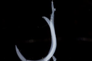 Is the worm turning? Early stages of schistosomiasis bladder infection charted