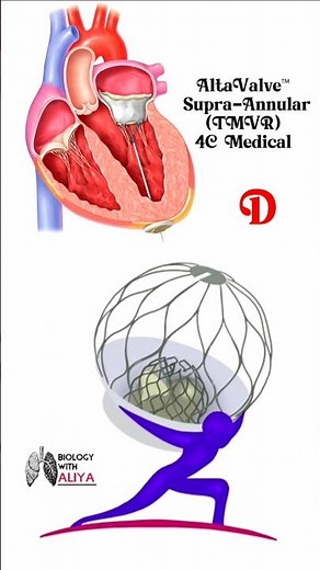 AltaValve™ Supra-Annular (TMVR) _ 4C Medical #medical #animation #3d #short | BiologywithAliya