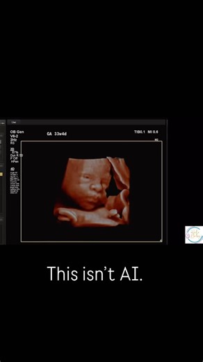 This isn’t AI. This is your baby 🤍 5D ultrasounds capture real expressions — blinking, smiling, opening that tiny mouth — moments you’ll never forget. #5DUltrasound #UltrasoundMagic #BabySmiles #PregnancyReels #MiamiUltrasound | Hello Baby Ultrasound