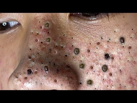 Relaxing Everyday With Loan Nguyen Skincare