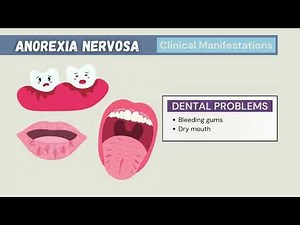 🌟 Understanding Anorexia Nervosa Animation 🌟