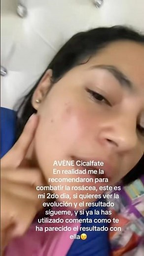 Crema AVÈNE Cicalfate para hidratar y combatir la rosácea 2do dia #avène #reels #cuidadodelrostro