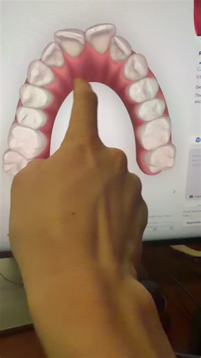 Optimizing Aesthetic Results with IPR Techniques