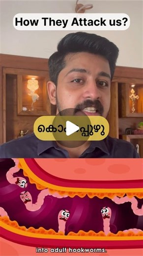 Hernold Paul on Instagram: "Don’t let hookworms hook you! These nasty parasites can enter your body through your feet and wreak havoc. Learn the ways you can get infected and the symptoms to watch out for so you can stay hookworm-free! #hookworm #healthknowledge #worm #childhealth #hygiene #footwear #health #worminfection #paediatric #habbit #awarness"