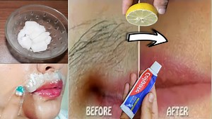16K views · 106 reactions | Farewell Unwanted Hair Painlessly: Easy DIY No-Razor Hair Removal Recipe! | YourBeauty Tv | Facebook