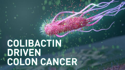How E. coli Bacteria Contribute to Colon Cancer | Science Animation | Ender Efe Cerit