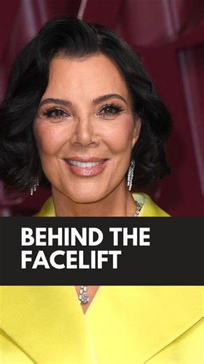 Kris Jenner’s recent public appearance shows the reality behind facelift expectations. Dr. Williams and Dr. Wasicek break down the truth behind the transformation. It’s important to understand that what you see online is not always the full reality of plastic surgery results or the healing process. Managing expectations with a trusted surgeon is key to a healthy approach and true satisfaction. 📞 (925) 875-0700 📍 Tri Valley Plastic Surgery | Dublin, CA | Tri Valley Plastic Surgery