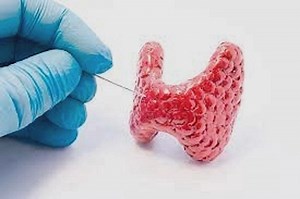 Punção guiada de nódulos de tireoide (PAAF) – saiba mais - ECOCENTER - Diagnóstico por imagem