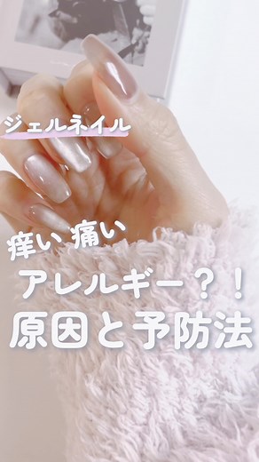 ジェルネイルアレルギーの原因と予防法