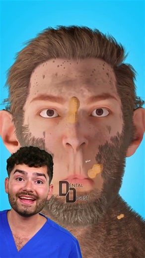 Dentist Explains: Evolution of Wisdom Teeth