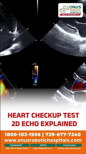 2D Echo Test_Meaning, Types, Procedure & Results – Dr. Syeda Saba