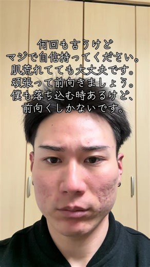 肌荒れを乗り越えよう！自信を持つ方法