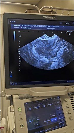 Septoplasty will be performed before Emberyo Transfer #infertility #pregnant #ivf