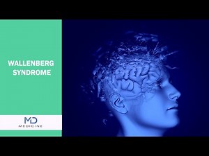 Understanding Wallenberg Syndrome: Causes, Symptoms, and Treatment - ‪@mdmedicine.network‬