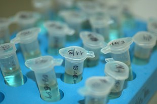 IGFBP-3 (Insulin-Like Growth Factor Binding Protein 3) Testing Fact Sheet