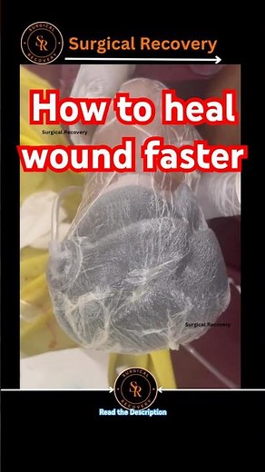 How to heal wound faster #woundcare #doctor #NPWT #shortfeed #healthawareness #surgicalrecovery #yt