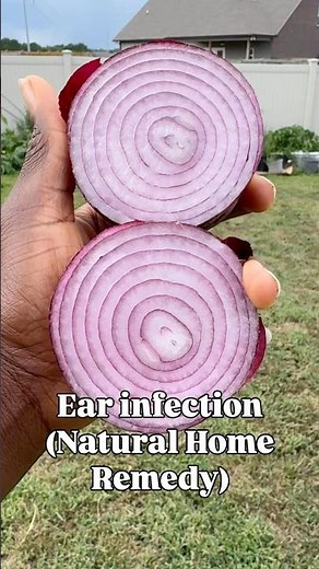 Natural home remedy for ear infection. #healthandwellness