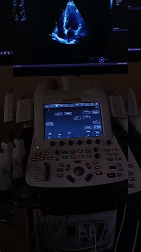 How to rule out APICAL HCM on behalf of ECHO & ECG ? #echocardiography #echofirst #echocardiology,🫀