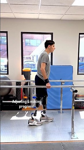 Azis’ First Steps with Prosthetics After Losing Both Legs in a Car Accident