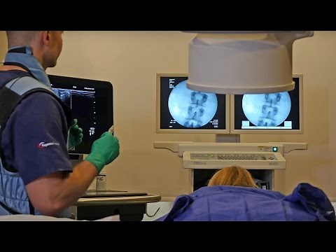 Regenexx Spine Procedure - Intra-Articular Facet Injections