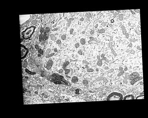 File:Photooxidation-Guided-Ultrastructural-Identification-and-Analysis-of-Cells-in-Neuronal-Tissue-pone.0064764.s009.ogv - Wikimedia Commons