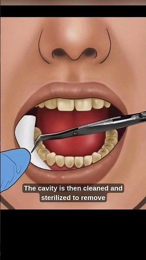 The Science Behind Teeth Cleaning & Filling Dental Care Explained