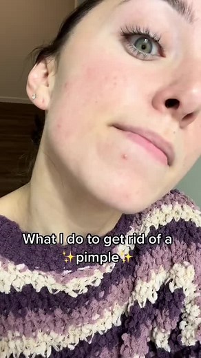 ITK Blemish Treatment Results | Before and After Skincare Routine