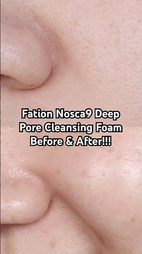 This "S'mores" Cleanser Shocked Me 🤯 | Nosca9 Deep Pore Cleansing Foam Review + Before & After