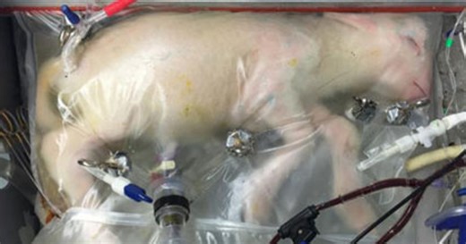 Artificial womb
