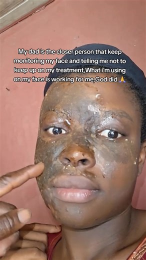 Effective Skin Treatment: Personal Insights and Tips