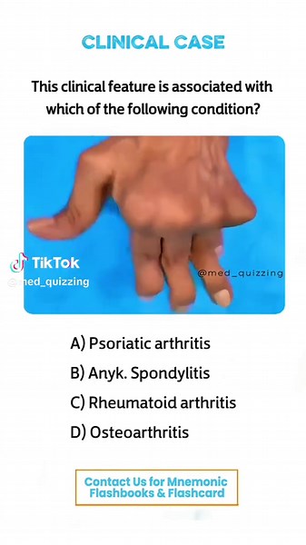 Comment “Details” and check your inbox for the full mnemonic flashbook & flashcards! 📕✨ . . . . . . #medical #medicine #medicalstudent #medicinestudent #usmle #step1 #plab #mrcp #medicine #reels #viral #foryou #anatomy #reelexplore #instagram #neurology #nephrology #surgery #students #colleges #cardiology #knowledge #virals #plab #UK #USA #newyork #nyc #neet
