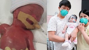 World's Smallest Surviving Baby Now FINALLY at Home