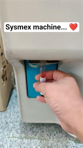 Cbc test machine (sysmex) or hematology analyzer