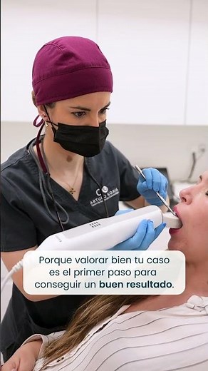 Los beneficios del escáner intraoral