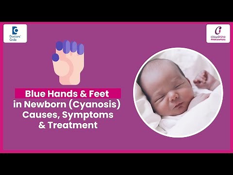 Cyanosis or Blue Skin Colour in Newborn Baby-Dr.Kumari Gunjan at Cloudnine Hospitals|Doctors' Circle