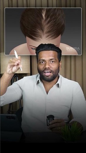 Over-Stress & Hair Fall: Causes, Timeline, Recovery