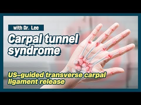 Trailer_Carpal tunnel syndrome, novel US-guided transverse carpal ligament release; Lecture; wrist
