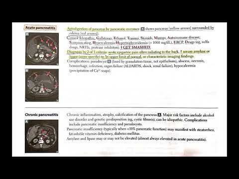 Acute & Chronic Pancreatitis Explained (In Hindi Podcast) #medicalpodcast #pancreatitis