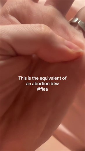Understanding the Controversial Abortion Debate