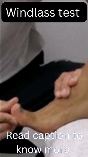 Windlass test to check plantar fascitis