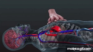 too fast CPR on Make a GIF