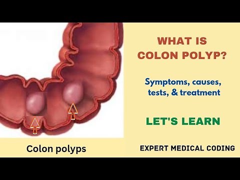 What is colon polyp? |Types|Symptoms|Causes|Complications|Tests|Treatment|Precautions|Medical coding