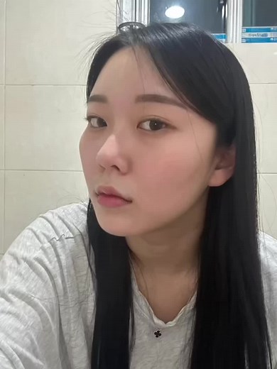 After 6 months of cheekbone reduction surgery Natural transformation ✨️ Over 20 years of experience and heritage you can trust. -WJ Wonjin —————————————————————————— Contact us for a FREE consultation🫶🏼 📲 821029374300 🔗 www.wonjinbeauty.com 📩 english@kwj.co.kr 💬 Kakao|Line ID wonjineng 📮 Instagram DM —————————————————————————— #WJwonjinplasticsurgery #WJ원진성형외과 #wonjinbeauty #cheekbone #cheekbonereduction #beforeafter #beforeandafter